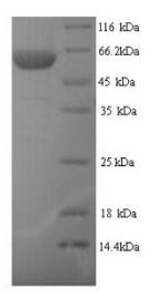 SDS-PAGE (TRIM21-5540H).jpg